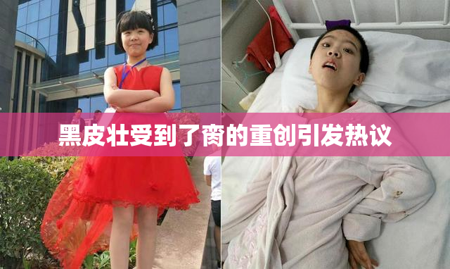 黑皮壮受到了脔的重创引发热议