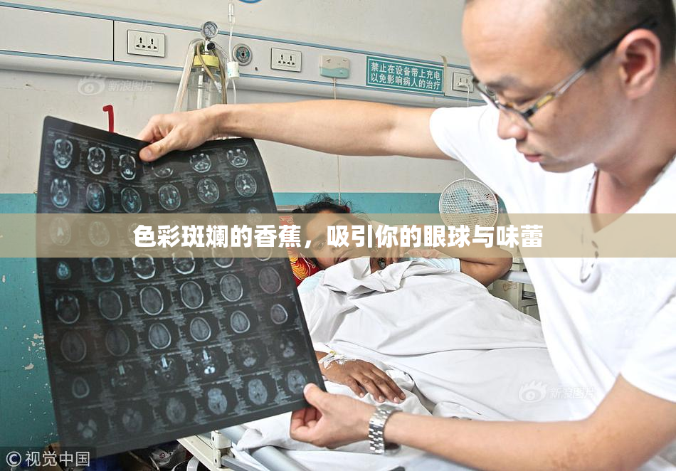 色彩斑斓的香蕉，吸引你的眼球与味蕾
