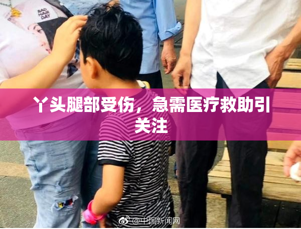丫头腿部受伤，急需医疗救助引关注