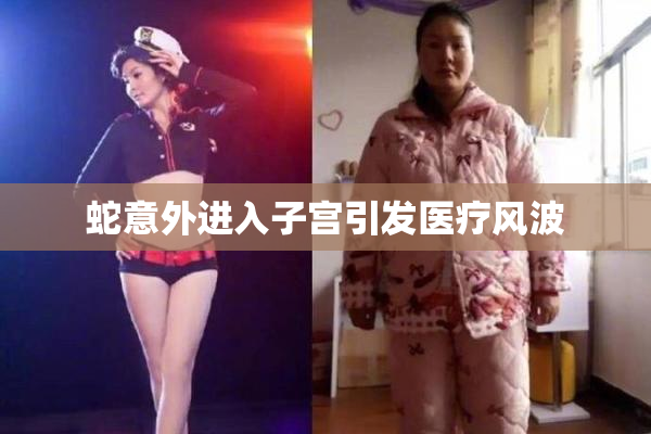 蛇意外进入子宫引发医疗风波