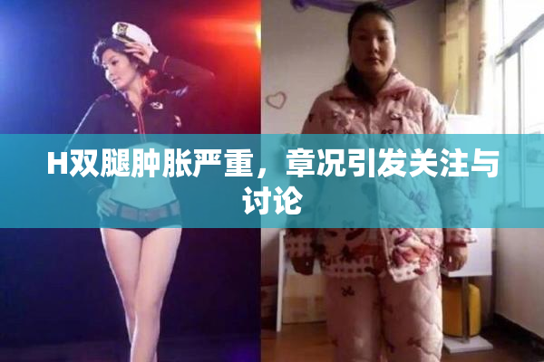 H双腿肿胀严重，章况引发关注与讨论