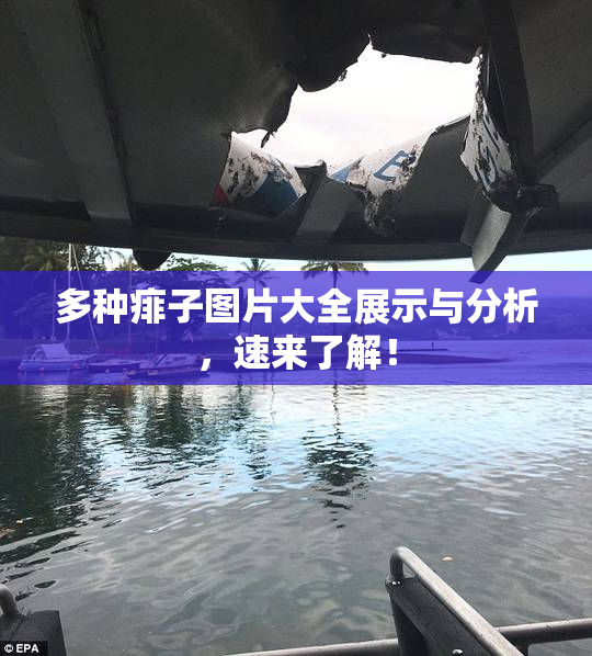 多种痱子图片大全展示与分析，速来了解！