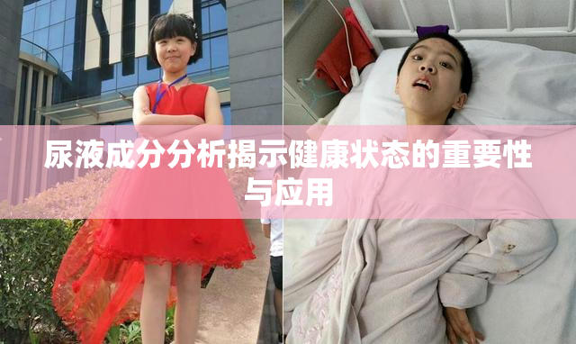 尿液成分分析揭示健康状态的重要性与应用