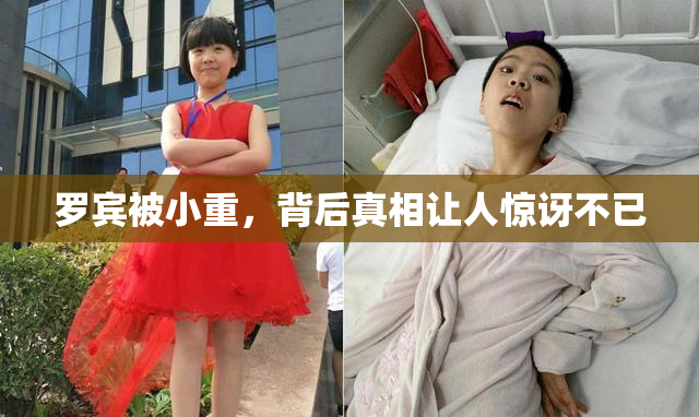 罗宾被小重，背后真相让人惊讶不已