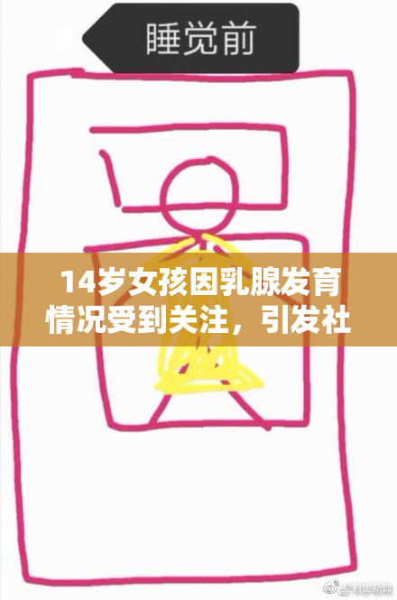 14岁女孩因乳腺发育情况受到关注，引发社会讨论