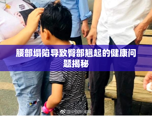 腰部塌陷导致臀部翘起的健康问题揭秘