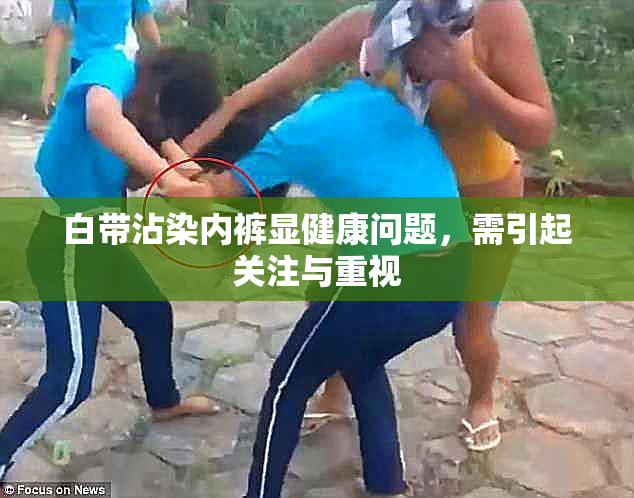 白带沾染内裤显健康问题，需引起关注与重视