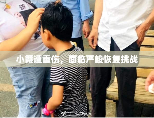 小舞遭重伤，面临严峻恢复挑战