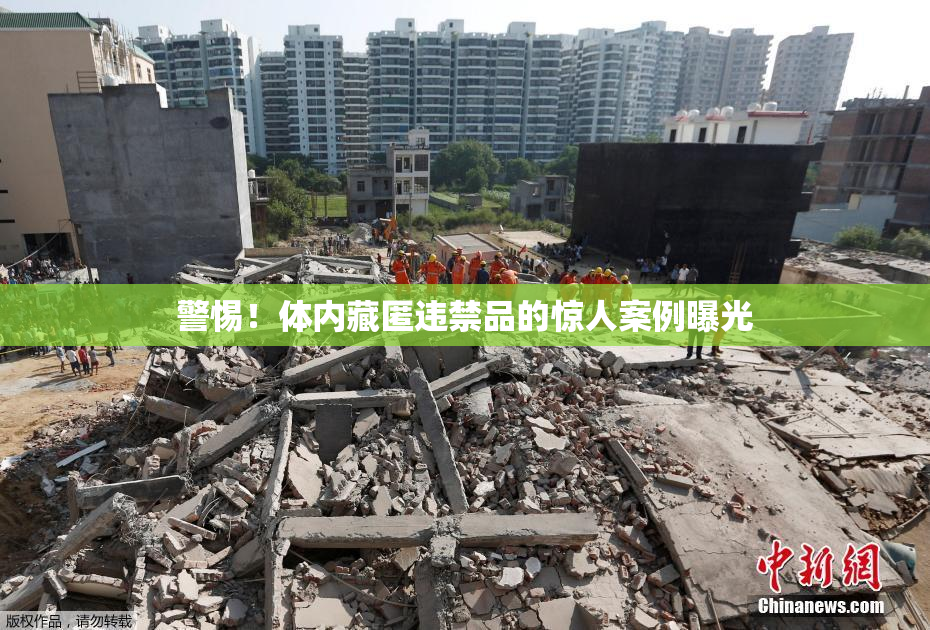 警惕！体内藏匿违禁品的惊人案例曝光