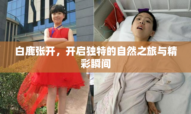 白鹿张开，开启独特的自然之旅与精彩瞬间