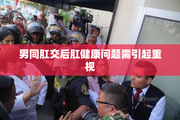 男同肛交后肛健康问题需引起重视